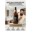 Yoğun Sakallara Bakım Yağı Yumuşatıcı Kaşıntı Kepek Önleyici Serum 100ml 723075
